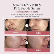 Medicube Salmon DNA PDRN Pink Peptide Serum, Pink glow serum, Peptide, Niacinamide, Hydrating & Moisturizing & Firming, Uneven Skin Tone, Korean Skincare