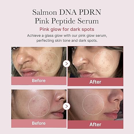 Medicube Salmon DNA PDRN Pink Peptide Serum, Pink glow serum, Peptide, Niacinamide, Hydrating & Moisturizing & Firming, Uneven Skin Tone, Korean Skincare